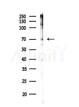 Phospho-AMPK alpha 1 (Ser486) Antibody - Western blot analysis of lysates from COLO205 cells(UV,30min treatment), using Phospho-AMPK alpha 1 (Ser486) Antibody at 1/1000 dilution.
