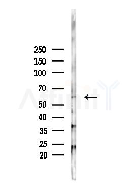 Phospho-AMPK alpha (Thr172) Antibody - Western blot analysis of lysates from PC12 cells(heat-shock,45min treatment), using Phospho-AMPK alpha (Thr172) Antibody at 1/1000 dilution.