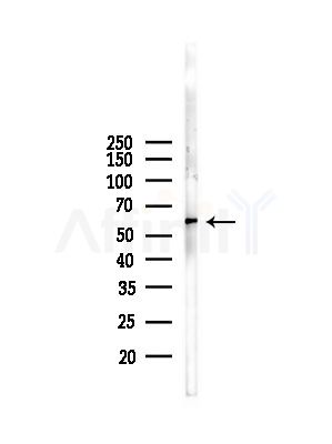 Phospho-G3BP-1 (Ser232) Antibody - Western blot analysis of lysates from Mouse liver, using Phospho-G3BP-1 (Ser232) Antibody at 1/1000 dilution.