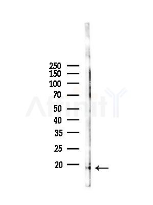 Phospho-4E-BP1 (Thr36) Antibody - Western blot analysis of lysates from Mouse liver, using Phospho-4E-BP1 (Thr36) Antibody at 1/1000 dilution.