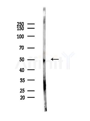 Phospho-IRF3 (Ser386) Antibody - Western blot analysis of lysates from LoVo cells(heat-shock,45min treatment), using Phospho-IRF3 (Ser386) Antibody at 1/1000 dilution.