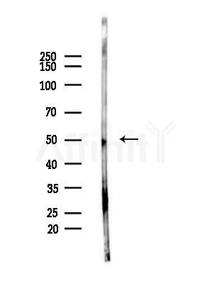 Phospho-IRF3 (Ser386) Antibody - Western blot analysis of lysates from LoVo cells(heat-shock,45min treatment), using Phospho-IRF3 (Ser386) Antibody at 1/1000 dilution.