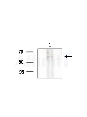 Phospho-Caspase 8 (Ser347) Antibody - Western blot analysis of extracts from COLO205 cells, using Phospho-Caspase 8 (Ser347) Antibody at 1/1000 dilution.