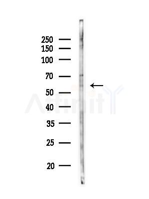 Phospho-Caspase 8 (Ser347) Antibody - Western blot analysis of lysates from COLO205 cells, using Phospho-Caspase 8 (Ser347) Antibody at 1/1000 dilution.