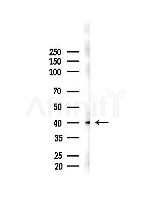 Phospho-IKB beta (Ser23) Antibody - Western blot analysis of lysates from Hela cells(heat-shock,45min treatment), using Phospho-IKB beta (Ser23) Antibody at 1/1000 dilution.