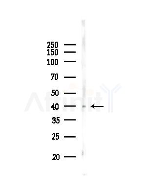Phospho-IKB beta (Ser23) Antibody - Western blot analysis of lysates from PC12 cells, using Phospho-IKB beta (Ser23) Antibody at 1/1000 dilution.