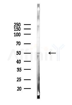Phospho-Smad2 (Ser467) Antibody - Western blot analysis of lysates from Hela cells(UV,30min treatment), using Phospho-Smad2 (Ser467) Antibody at 1/1000 dilution.