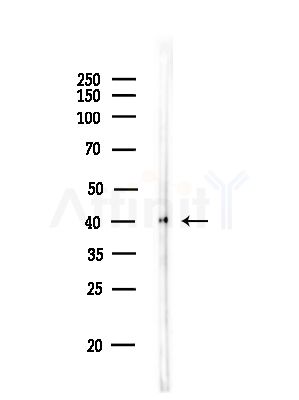 Phospho-p38 MAPK (Tyr182) Antibody - Western blot analysis of lysates from Rat lung, using Phospho-p38 MAPK (Tyr182) Antibody at 1/1000 dilution.