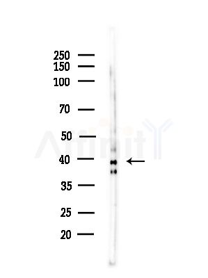 Phospho-p38 MAPK (Tyr182) Antibody - Western blot analysis of lysates from PC12 cells(starvation,24h treatment), using Phospho-p38 MAPK (Tyr182) Antibody at 1/1000 dilution.