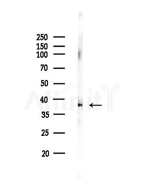 Phospho-p38 MAPK (Tyr182) Antibody - Western blot analysis of lysates from COLO205 cells(heat-shock,45min treatment), using Phospho-p38 MAPK (Tyr182) Antibody at 1/1000 dilution.