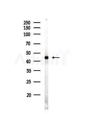 Phospho-CDC37 (Ser13) Antibody - Western blot analysis of lysates from EC304 cells, using Phospho-CDC37 (Ser13) Antibody at 1/1000 dilution.