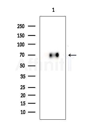 Phospho-CRMP2 (Thr514) Antibody - Western blot analysis of extracts from Mouse brain, using Phospho-CRMP2 (Thr514) Antibody at 1/1000 dilution.