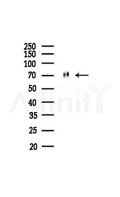 Phospho-CRMP2 (Thr514) Antibody - Western blot analysis of lysates from Mouse brain, using Phospho-CRMP2 (Thr514) Antibody at 1/1000 dilution.