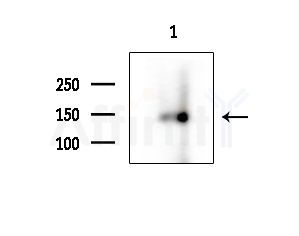 Phospho-Trk B (Tyr706) Antibody - Western blot analysis of extracts from COLO205 cells, using Phospho-TrkB (Tyr706) Antibody at 1/1000 dilution.