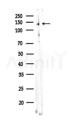 Phospho-Trk B (Tyr706) Antibody - Western blot analysis of lysates from COLO205 cells, using Phospho-TrkB (Tyr706) Antibody at 1/1000 dilution.