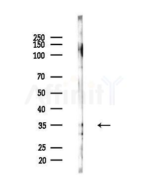 Phospho-Syntaxin 1A (Ser14) Antibody - Western blot analysis of lysates from B16F10-LUC cells(UV,30min treatment), using Phospho-Syntaxin 1A (Ser14) Antibody at 1/1000 dilution.