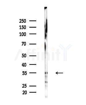 Phospho-Syntaxin 1A (Ser14) Antibody - Western blot analysis of lysates from MCF7 cells(heat-shock,45min treatment), using Phospho-Syntaxin 1A (Ser14) Antibody at 1/1000 dilution.