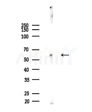 Phospho-Estrogen Receptor-beta (Ser105) Antibody - Western blot analysis of lysates from B16F10-LUC cells(UV,30min treatment), using Phospho-Estrogen Receptor-beta (Ser105) Antibody at 1/1000 dilution.
