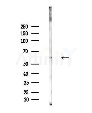 Phospho-Estrogen Receptor-beta (Ser105) Antibody - Western blot analysis of lysates from MCF7 cells(heat-shock,45min treatment), using Phospho-Estrogen Receptor-beta (Ser105) Antibody at 1/1000 dilution.