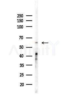 Phospho-HDAC2 (Ser394) Antibody - Western blot analysis of lysates from HUVEC cells(UV,30min treatment), using Phospho-HDAC2 (Ser394) Antibody at 1/1000 dilution.