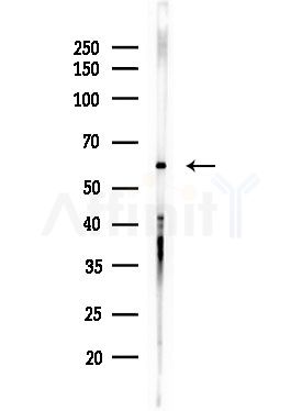 Phospho-HDAC2 (Ser394) Antibody - Western blot analysis of lysates from Hela cells(starvation,24h treatment), using Phospho-HDAC2 (Ser394) Antibody at 1/1000 dilution.