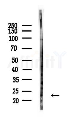 Phospho-BAD (Ser155)[Ser118] Antibody - Western blot analysis of lysates from A375 cells(heat-shock,45min treatment), using Phospho-BAD (Ser155)[Ser118] Antibody at 1/1000 dilution.