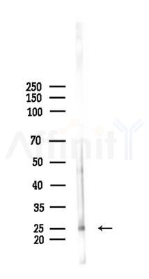 Phospho-CPI17alpha (Thr38) Antibody - Western blot analysis of lysates from Rat brain, using Phospho-CPI17alpha (Thr38) Antibody at 1/1000 dilution.