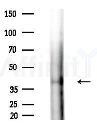 Phospho-AurB (Thr232) Antibody - Western blot analysis of extracts from Rat brain, using Phospho-AurB (Thr232) Antibody at 1/1000 dilution.