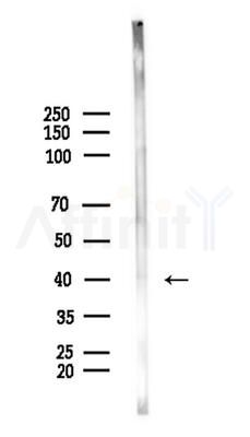 Phospho-AurB (Thr232) Antibody - Western blot analysis of lysates from Rat brain, using Phospho-AurB (Thr232) Antibody at 1/1000 dilution.