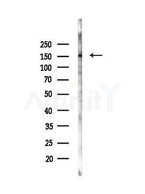 Phospho-ASK1 (Ser966) Antibody - Western blot analysis of lysates from COLO205 cells(heat-shock,45min treatment), using Phospho-ASK1 (Ser966) Antibody at 1/1000 dilution.
