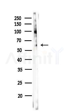 Phospho-p62Dok (Tyr398) Antibody - Western blot analysis of lysates from COLO205 cells, using Phospho-p62Dok (Tyr398) Antibody at 1/1000 dilution.