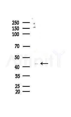 Phospho-HDAC8 (Ser39) Antibody - Western blot analysis of lysates from EC304 cells, using Phospho-HDAC8 (Ser39) Antibody at 1/1000 dilution.
