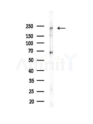Phospho-WNK1 (Thr60) Antibody - Western blot analysis of lysates from COLO205 cells(heat-shock,45min treatment), using Phospho-WNK1 (Thr60) Antibody at 1/1000 dilution.
