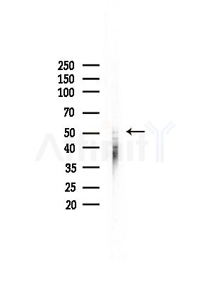 Phospho-p70 S6 Kinase beta (Ser423) Antibody - Western blot analysis of lysates from COLO205 cells, using Phospho-p70 S6 Kinase beta (Ser423) Antibody at 1/1000 dilution.