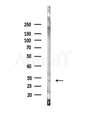 Phospho-DARPP32 (Thr34) Antibody - Western blot analysis of lysates from COLO205 cells(heat-shock,45min treatment), using Phospho-DARPP32 (Thr34) Antibody at 1/1000 dilution.