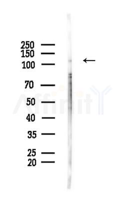 Phospho-HDAC5 (Ser498) Antibody - Western blot analysis of lysates from COLO205 cells(heat-shock,45min treatment), using Phospho-HDAC5 (Ser498) Antibody at 1/1000 dilution.