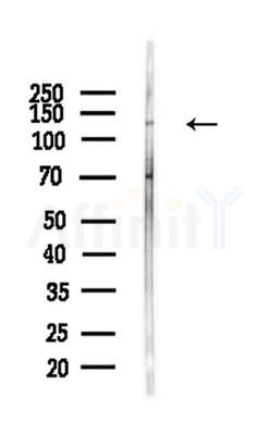 Phospho-HDAC5 (Ser498) Antibody - Western blot analysis of lysates from A375 cells(heat-shock,45min treatment), using Phospho-HDAC5 (Ser498) Antibody at 1/1000 dilution.