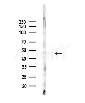 Phospho-CaMKII alpha/beta/delta (Thr305) Antibody - Western blot analysis of lysates from Hela cells(starvation,24h treatment), using Phospho-CaMKII alpha/beta/delta (Thr305) Antibody at 1/1000 dilution.