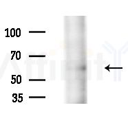 Phospho-CaMKII alpha/delta (Thr286) Antibody - Western blot analysis of extracts from COLO205 cells(heat-shock,45min treatment), using Phospho-CaMKII alpha/delta (Thr286) Antibody at 1/1000 dilution.
