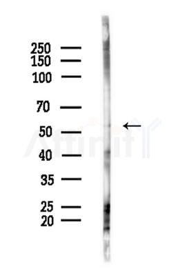 Phospho-CaMKII alpha/delta (Thr286) Antibody - Western blot analysis of lysates from COLO205 cells(heat-shock,45min treatment), using Phospho-CaMKII alpha/delta (Thr286) Antibody at 1/1000 dilution.