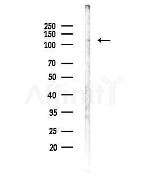 Phospho-MORC2 (Ser615) Antibody - Western blot analysis of lysates from MDA-MB-231 cells, using Phospho-MORC2 (Ser615) Antibody at 1/1000 dilution.