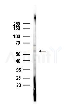 Phospho-PFKFB3 (Ser461) Antibody - Western blot analysis of lysates from Mouse brain, using Phospho-PFKFB3 (Ser461) Antibody at 1/1000 dilution.