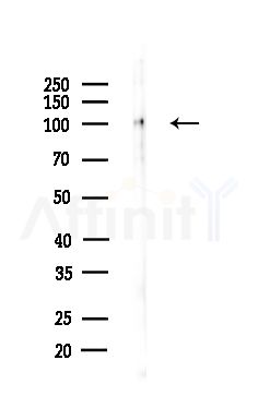 Phospho-EZH2 (Thr345) Antibody - Western blot analysis of lysates from Hela cells(LPS,4h treatment), using Phospho-EZH2 (Thr345) Antibody at 1/1000 dilution.