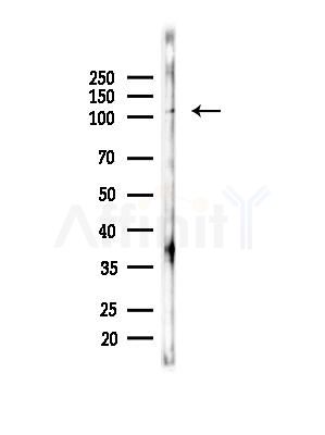Phospho-SRPK2 (Thr492) Antibody - Western blot analysis of lysates from PC12 cells(heat-shock,45min treatment), using Phospho-SRPK2 (Thr492) Antibody at 1/1000 dilution.