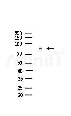Phospho-PSD95 (Ser418) Antibody - Western blot analysis of lysates from Mouse brain, using Phospho-PSD95 (Ser418) Antibody at 1/1000 dilution.