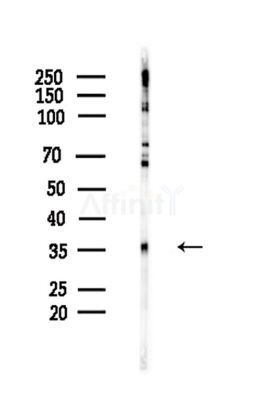 Phospho-PPP1CA (Thr320) Antibody - Western blot analysis of lysates from Hela cells(LPS,4h treatment), using Phospho-PPP1CA (Thr320) Antibody at 1/1000 dilution.