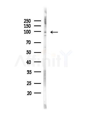 Phospho-STAT2 (Thr387) Antibody - Western blot analysis of lysates from PC12 cells(heat-shock,45min treatment), using Phospho-STAT2 (Thr387) Antibody at 1/1000 dilution.