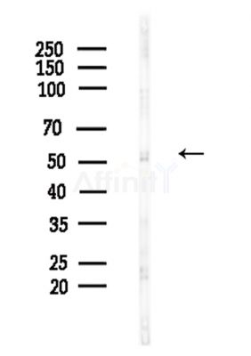 Phospho-MAP3K8/COT (Ser443) Antibody - Western blot analysis of lysates from Hela cells(LPS,4h treatment), using Phospho-MAP3K8/COT (Ser443) Antibody at 1/1000 dilution.