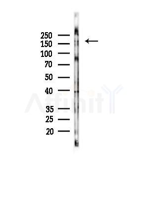 Phospho-Dnmt1 (Ser714) Antibody - Western blot analysis of lysates from MCF7 cells(heat-shock,45min treatment), using Phospho-Dnmt1 (Ser714) Antibody at 1/1000 dilution.