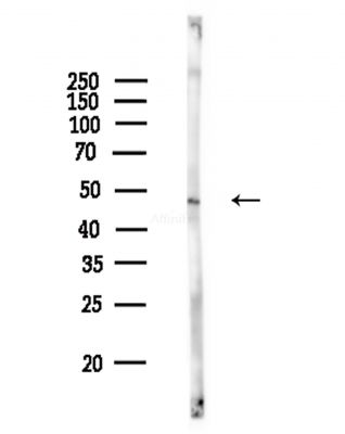 Phospho-FAS (Tyr291) Antibody - Western blot analysis of lysates from COLO205 cells(heat-shock,45min treatment), using Phospho-FAS (Tyr291) Antibody at 1/1000 dilution.